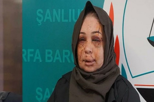 Evli olduğu kadına şiddet uygulayan Cumhurbaşkanlığı koruması tutuklandı