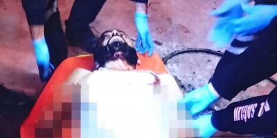 Şireci Tekstil'de bir işçinin iş kazası sonucu iki kolunun koptuğu açıklandı